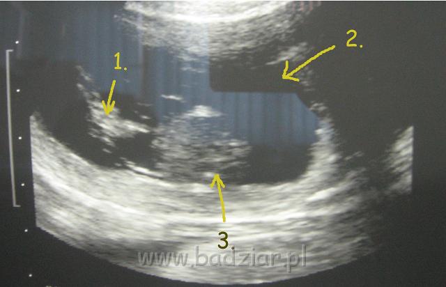 podhalan_7008.jpg - Owczarek Podhalański - Zdjęcie obrazu USG w 40 dniu ciąży. 1- łżysko, 2- wody płodowe, 3- płód.